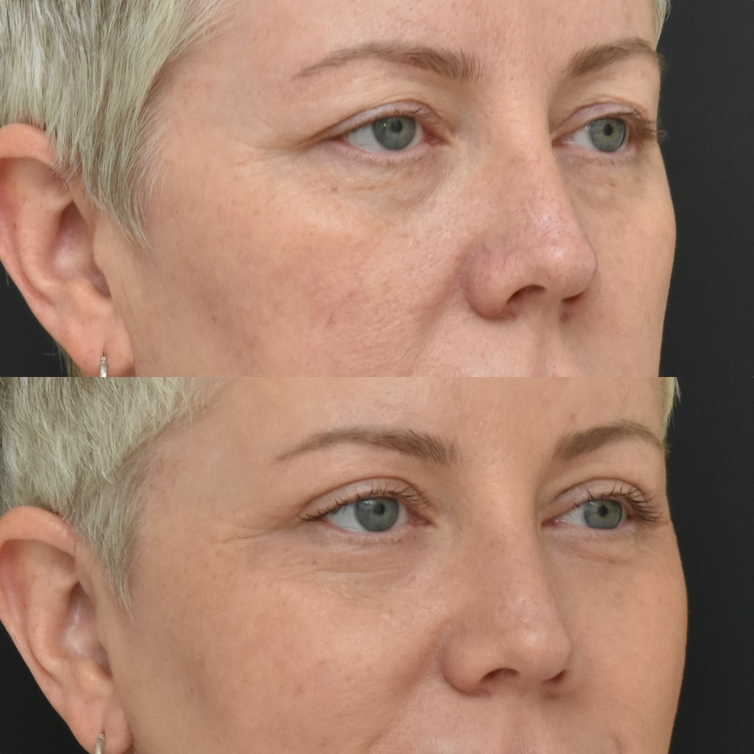 Side-by-side comparison of facial appearance changes.