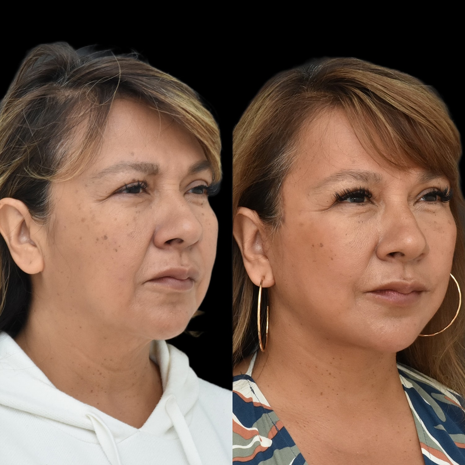 Comparison of two women's faces side by side.