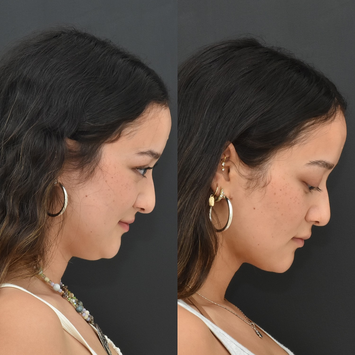 Profile comparison showing before and after results.