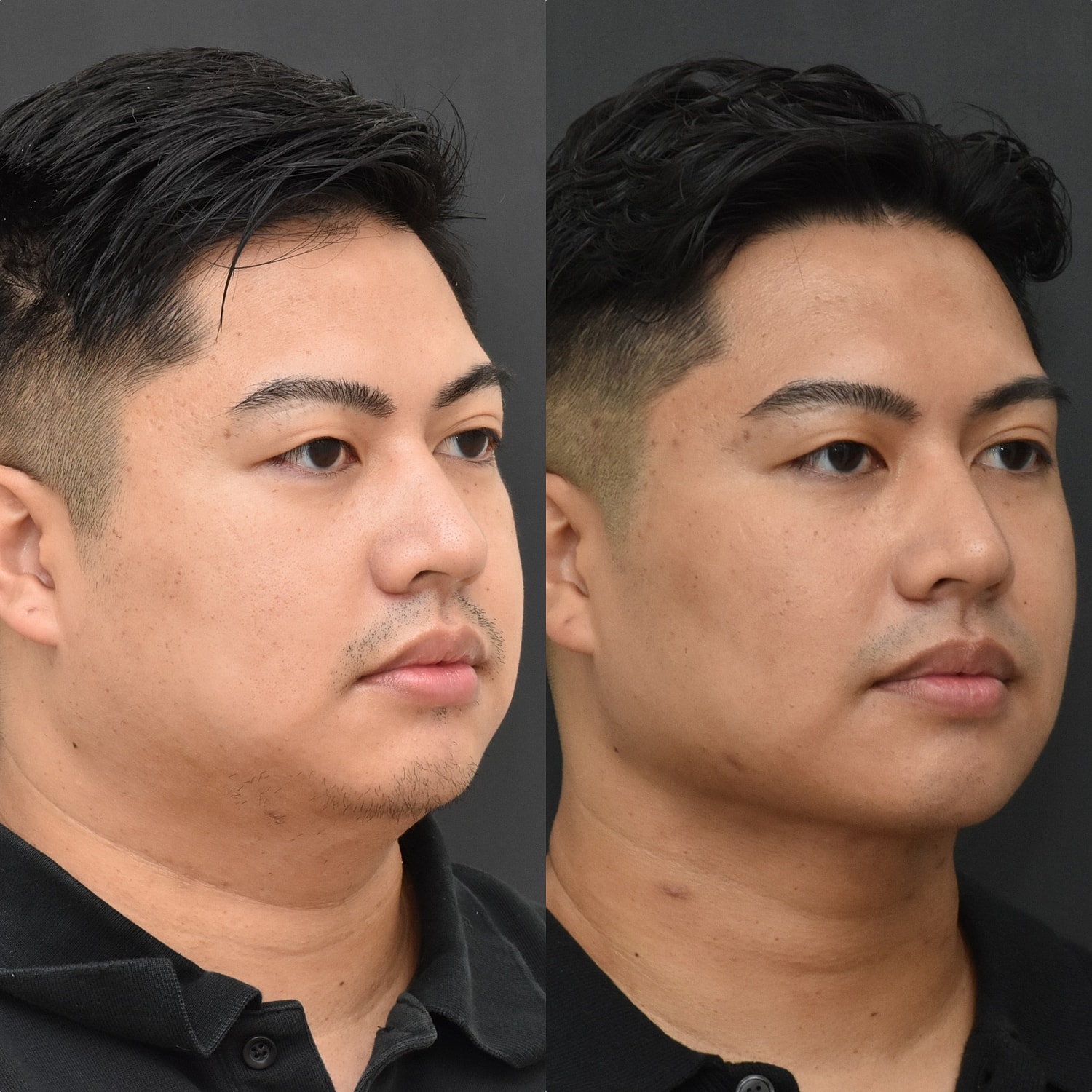 Newport Beach facial plastic surgeon consulting with patient in office setting.