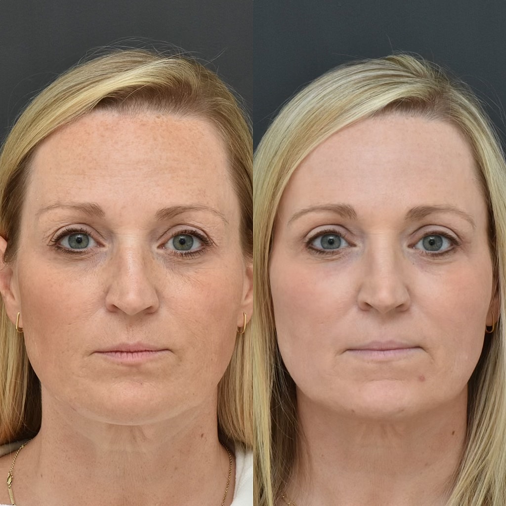 Comparison of two women’s facial features.