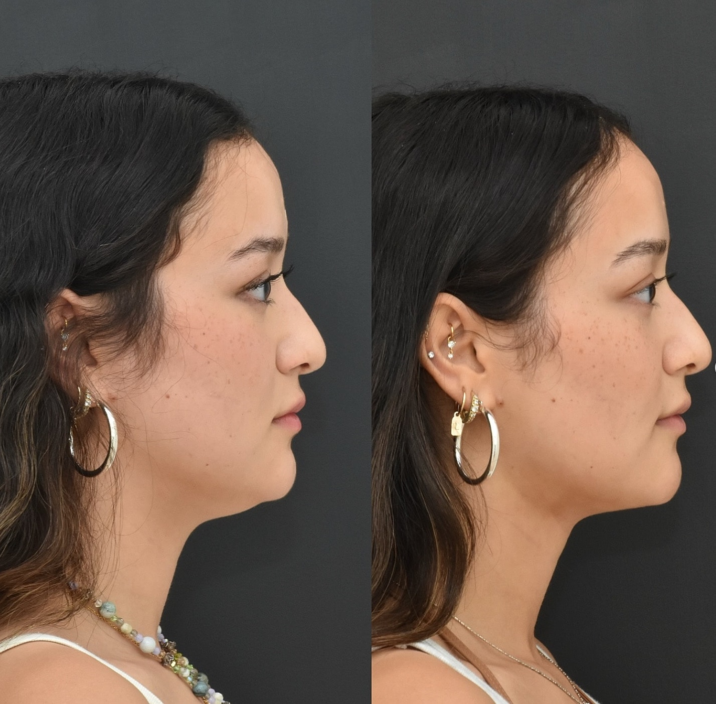 Profile comparison of a woman with earrings.