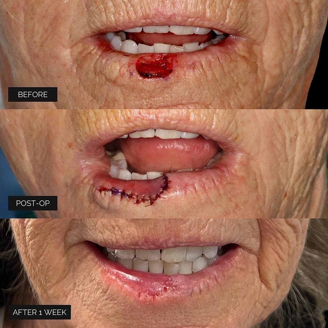 Reconstruction Before & After