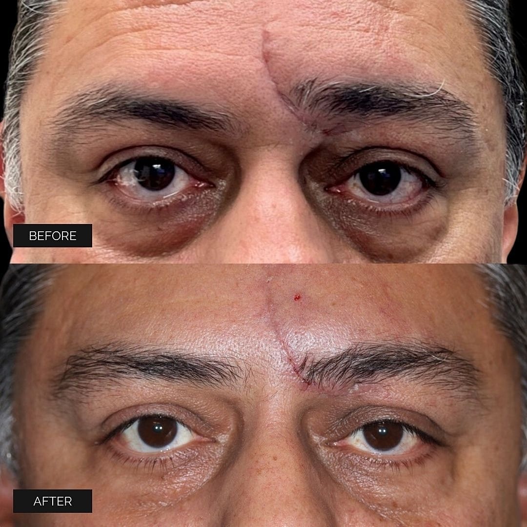 Reconstruction Before & After