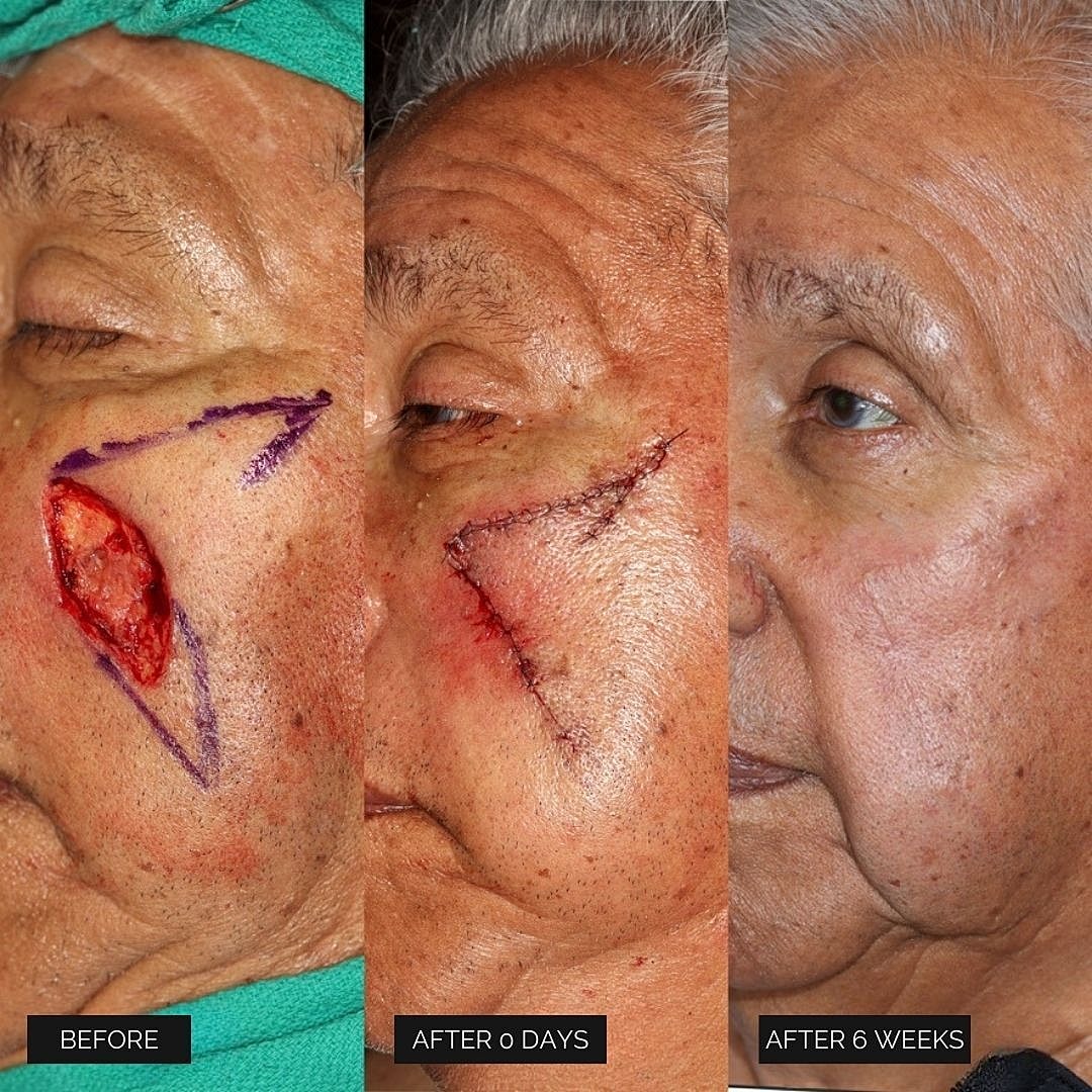 Reconstruction Before & After