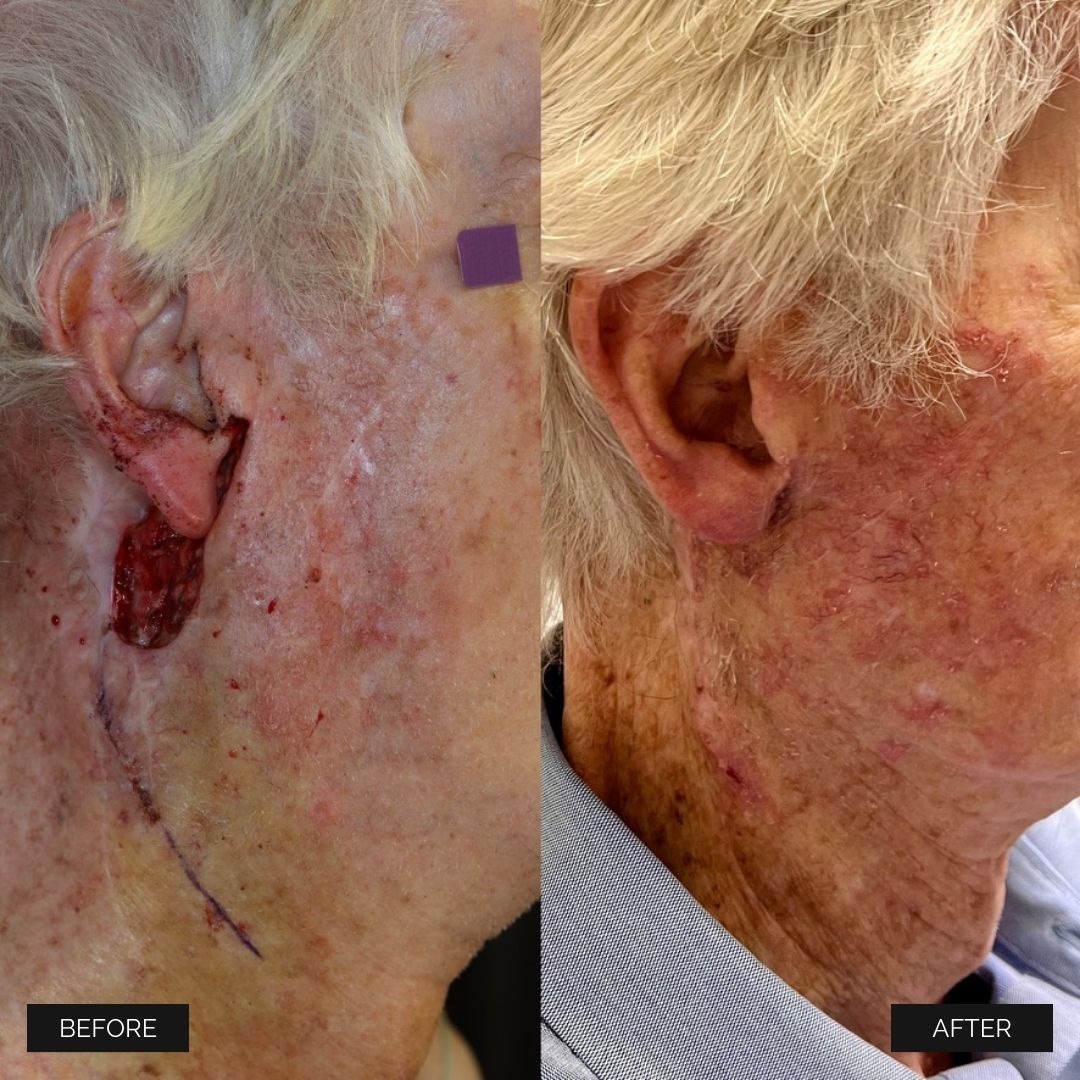 Reconstruction Before & After