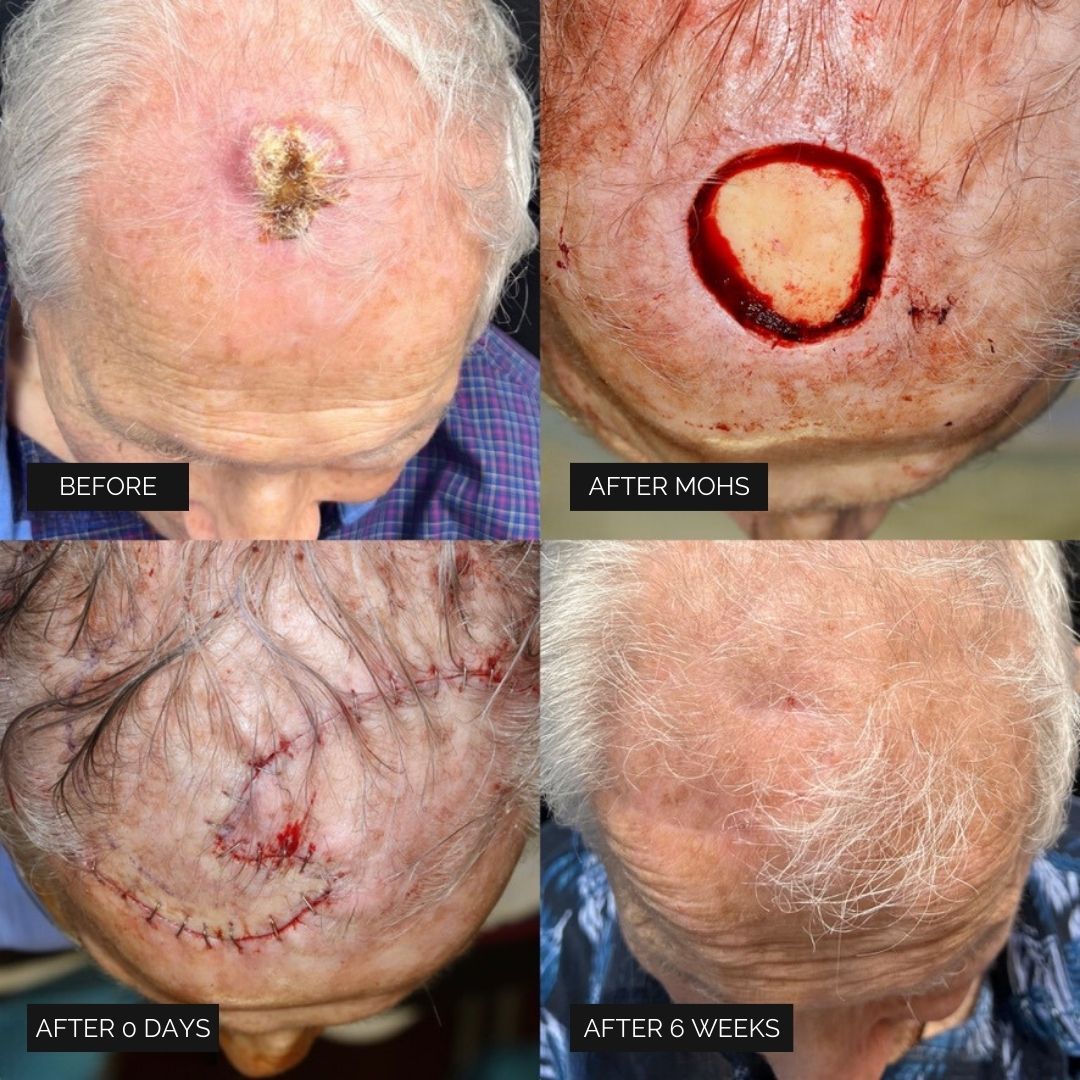 Reconstruction Before & After