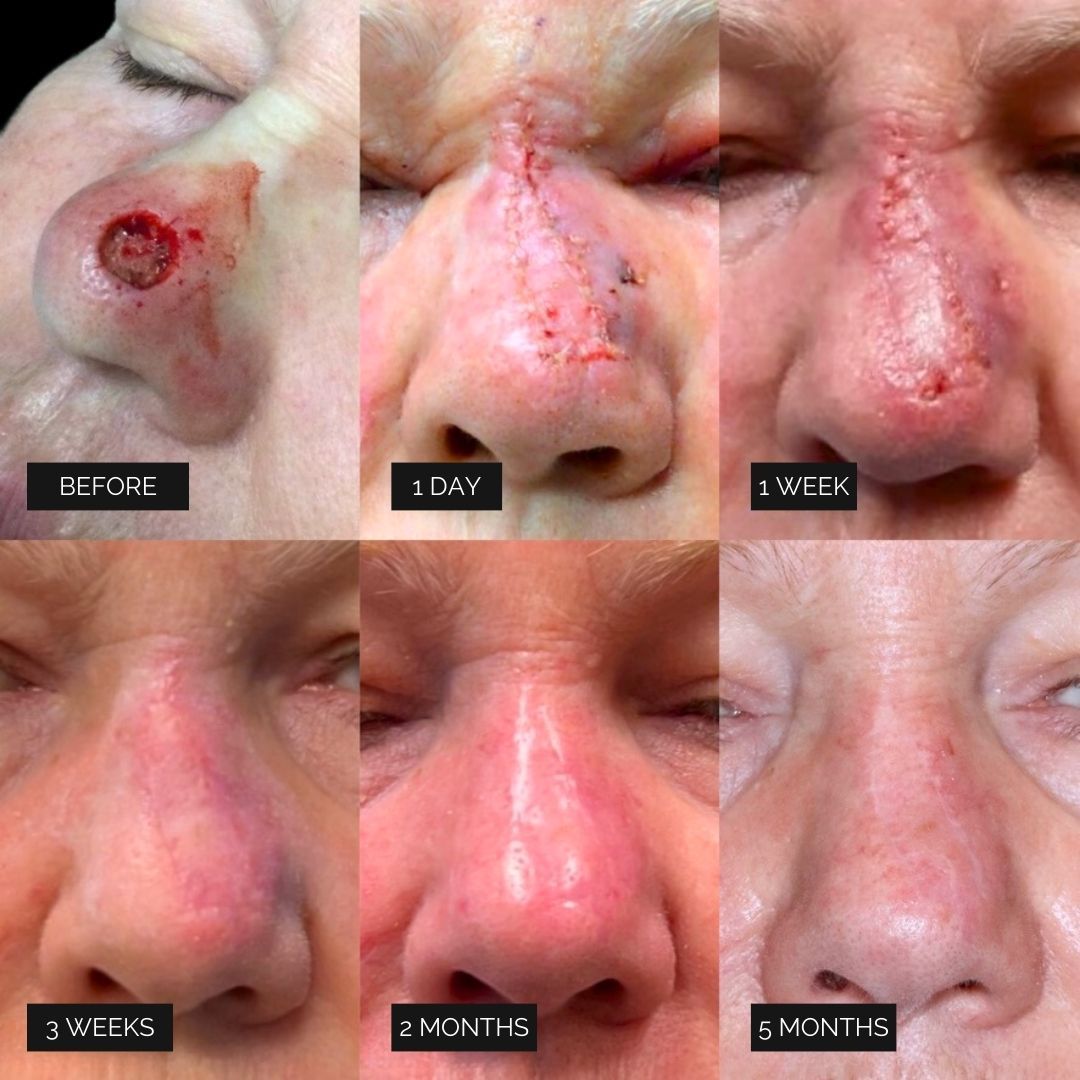 Reconstruction Before & After