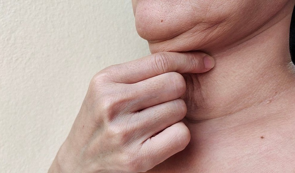 Redefining Jawlines in Newport Beach: How Chin Liposuction Enhances Your Profile